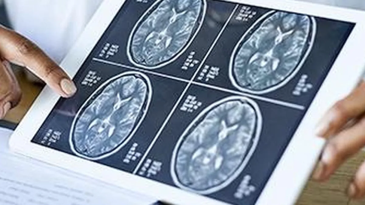 Doctor discussing a brain scan with a patient